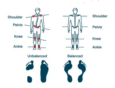posture_align